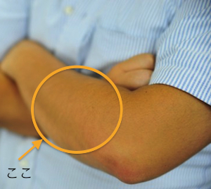 forearm1.jpg