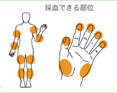 痛くない血糖値測定器はニプロ フリースタイル だと思う 医療ライター阿南の 血糖値にいい取材こぼれ話